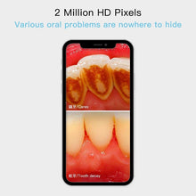 Load image into Gallery viewer, Dental Camera Endoscope